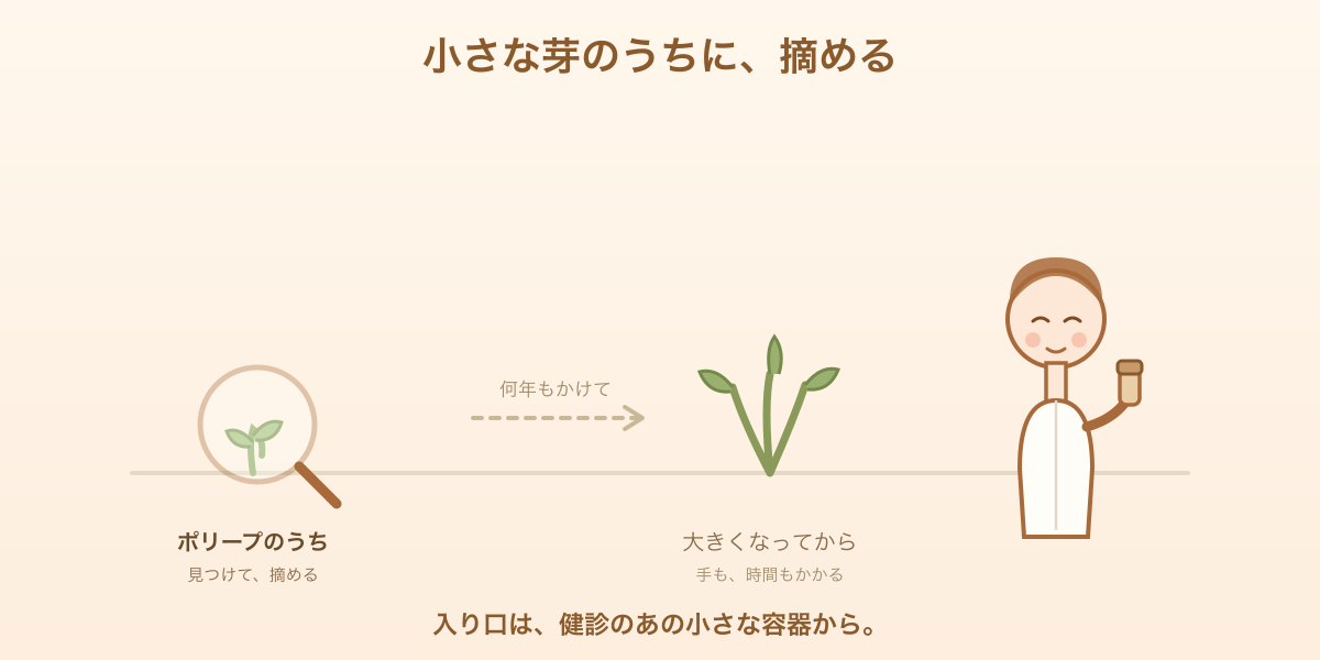 大腸の中の小さなポリープを虫めがねで見つけるイラスト。小さな芽のうちに摘める