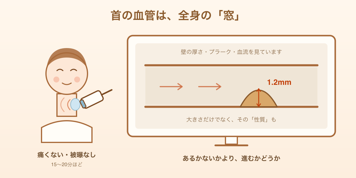 頸動脈エコー——首の血管を超音波で見る検査。壁の厚さ・プラーク・血流を観察する