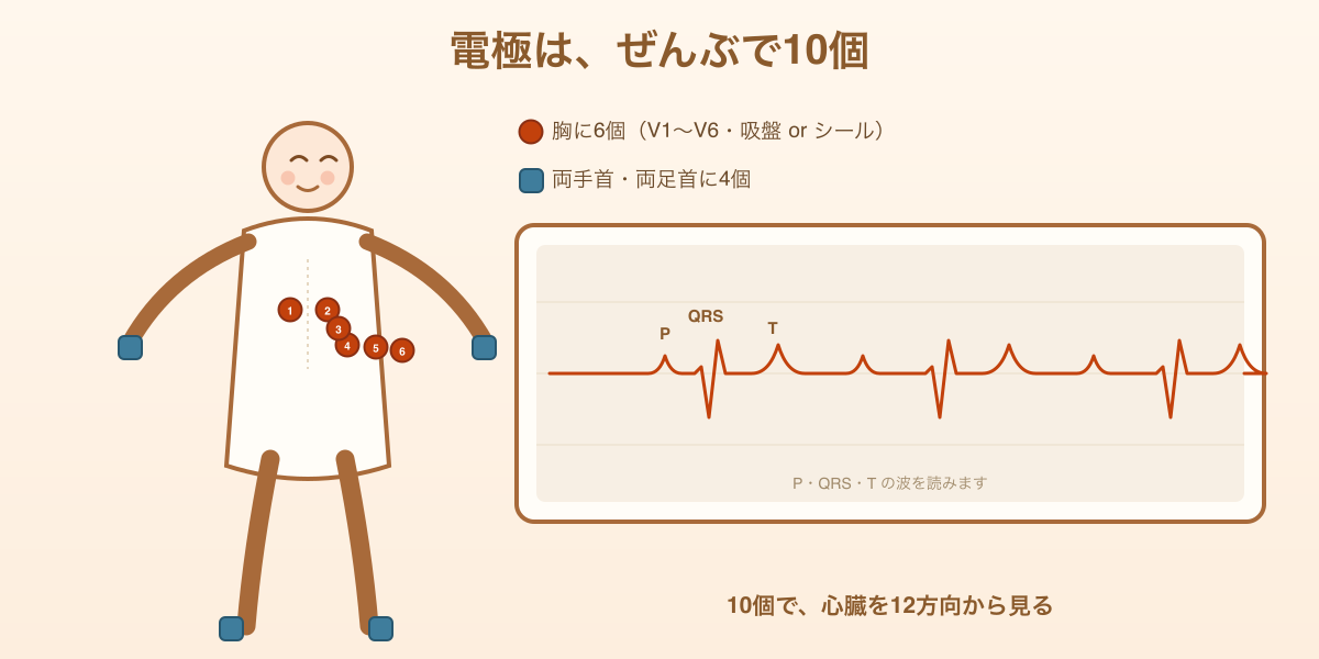 心電図検査——胸に6個、両手首・両足首に4個、ぜんぶで10個の電極をつけて心臓の電気を記録する